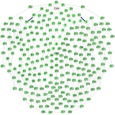 Investigating brain cortical activity in patients with post-COVID-19 brain fog